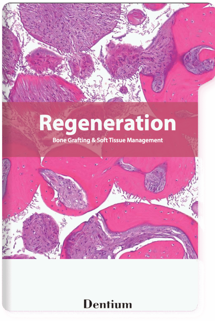 Regeneration Materials