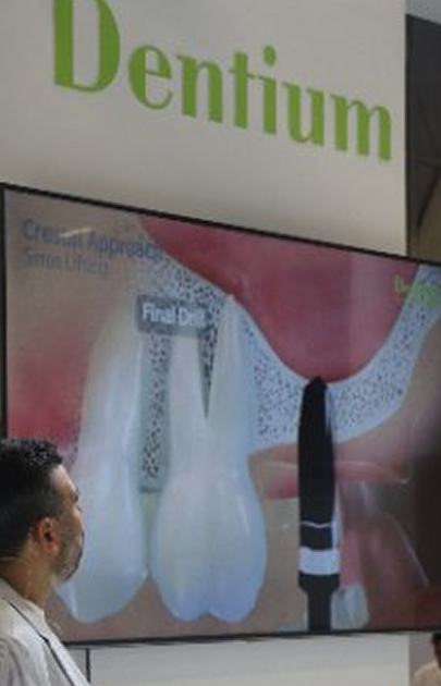 Trusted Implant System